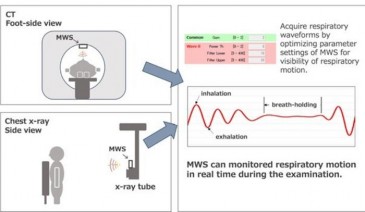 World's First Non-contact Respiratory Motion Monitoring System for...