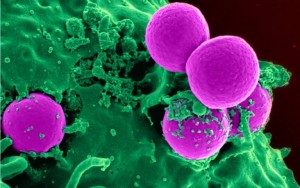 UCL Researchers Develop Light-Activated Coating that Kills Bacteria ...