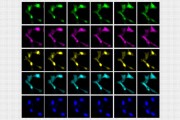 A sequence of images showing cells in transition Photo by MIT